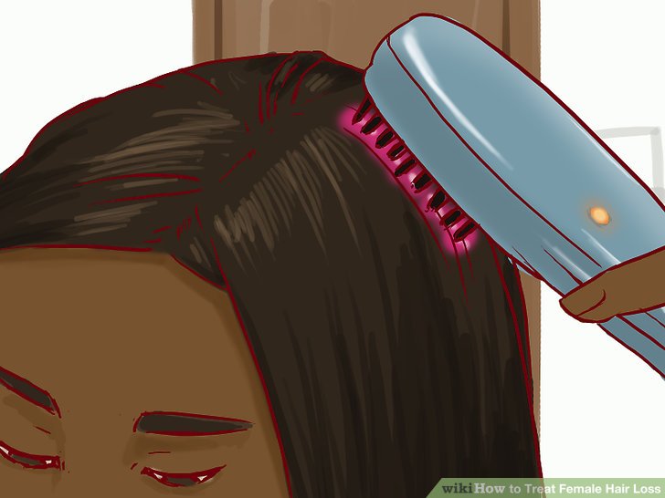 How to Treat Female Hair Loss (with Pictures)