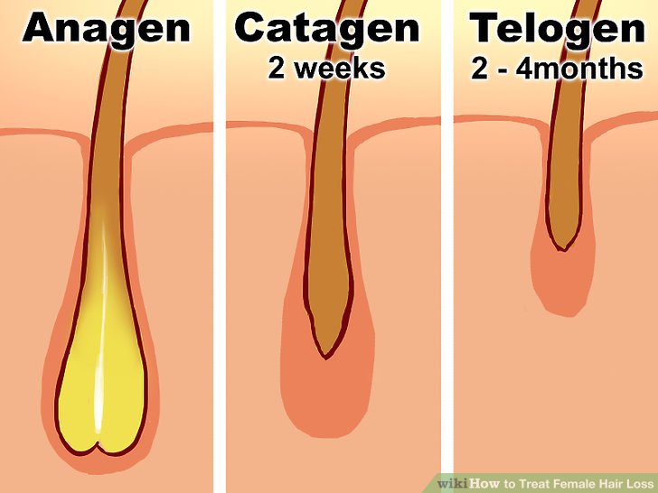 How to Treat Female Hair Loss (with Pictures)