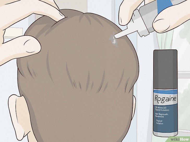 How to Regrow Hair: Can Natural Remedies Help?