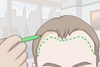 How to Regrow Hair: Can Natural Remedies Help?