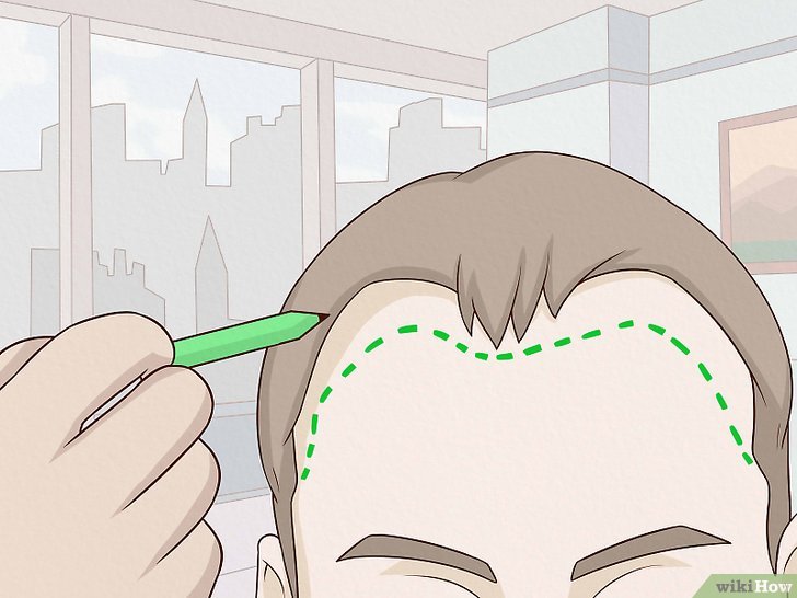 How to Regrow Hair: Can Natural Remedies Help?